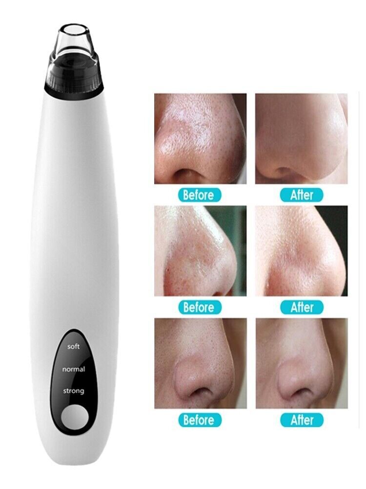 Electric pore vacuum for the nose, chin, forehead and cheeks
